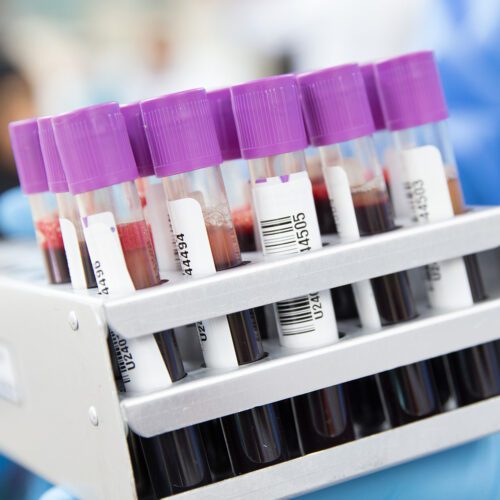 Labelled vials of blood